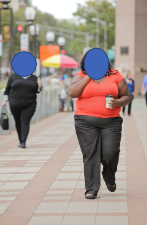 Obesità e postura